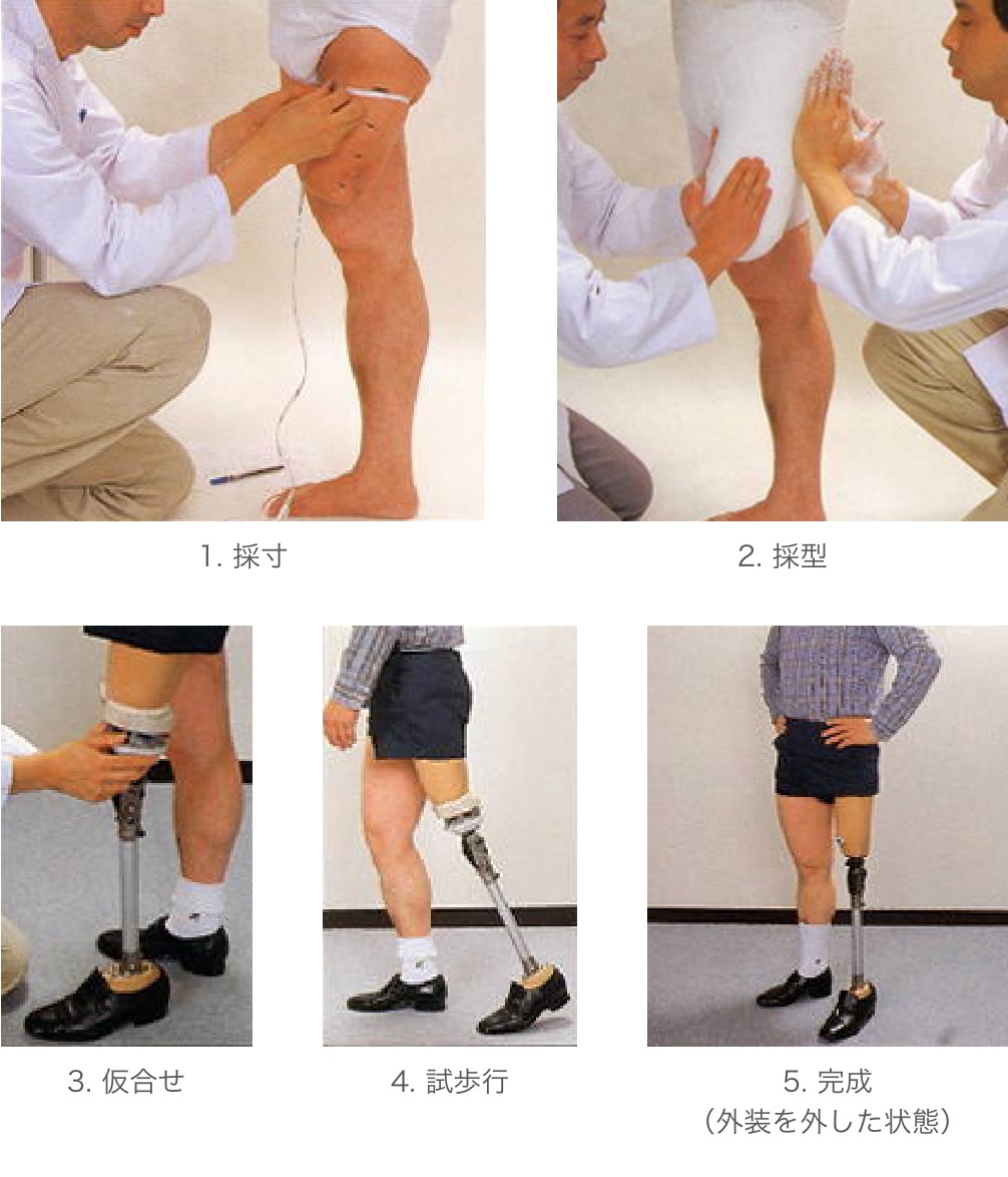 義肢ができるまで