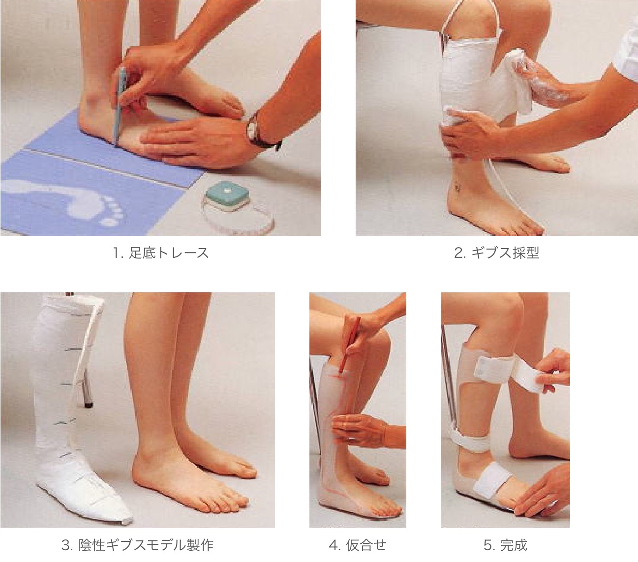 装具ができるまで